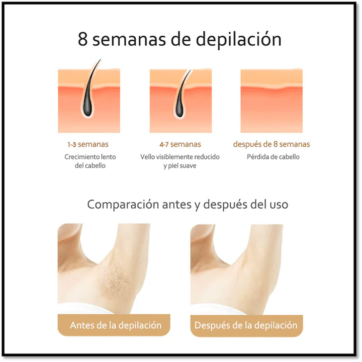 DEPILADORA LASER IPL